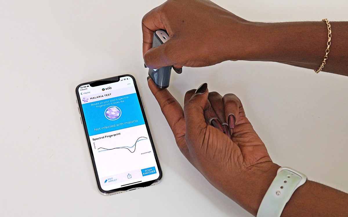 Alat za otkrivanje malarije prikuplja infracrveni potpis za trenutnu obradu podataka na mobilnom telefonu