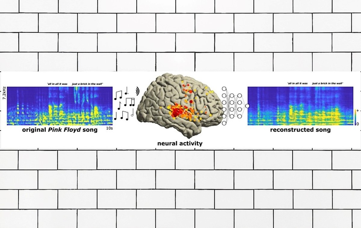 Neuroznanstvenici su bilježili električnu aktivnost iz područja mozga (žute i crvene točke) dok su pacijenti slušali 