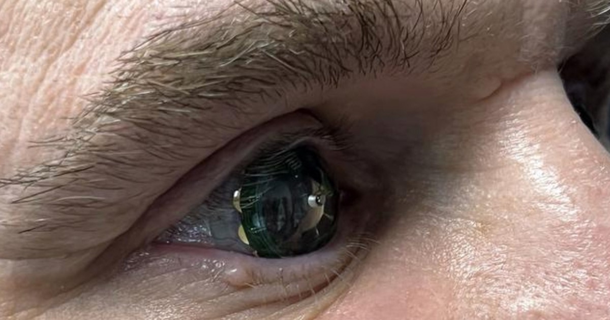 Pametne kontaktne leće dobile tehnologiju proširene stvarnosti -  Tehnologije @ Bug.hr