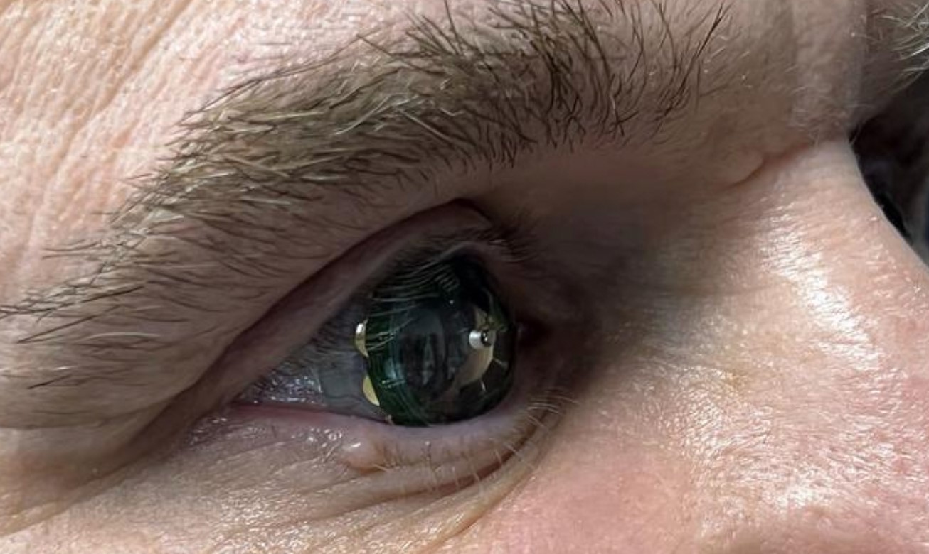 Pametne kontaktne leće dobile tehnologiju proširene stvarnosti -  Tehnologije @ Bug.hr